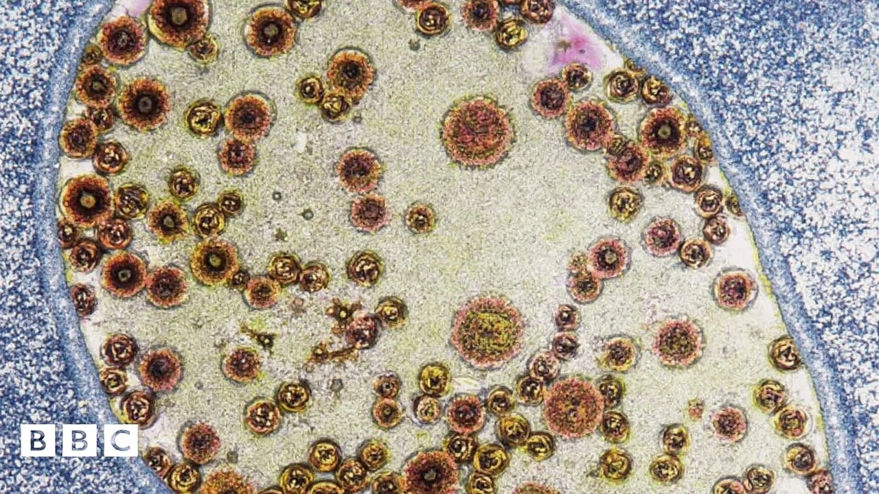 Rwanda Ends Marburg Virus Outbreak After Rapid Public Health Response