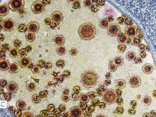 Rwanda Ends Marburg Virus Outbreak After Rapid Public Health Response